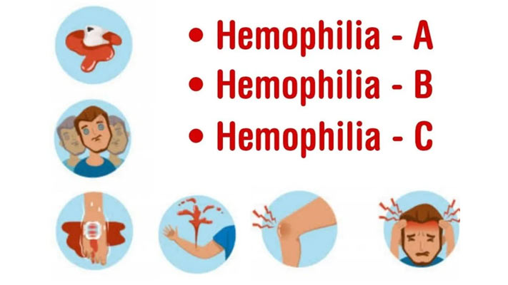 Hemophilia with Inhibitors